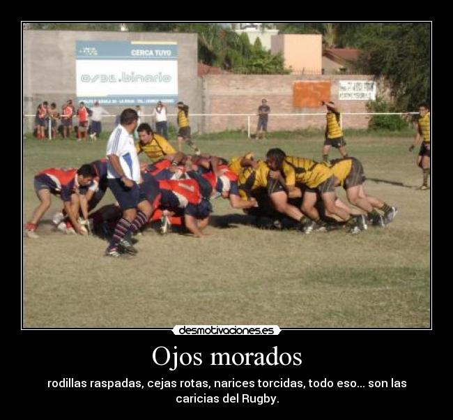 Ojos morados - rodillas raspadas, cejas rotas, narices torcidas, todo eso... son las caricias del Rugby.