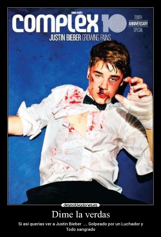 Dime la verdas - Si así querias ver a Justin Bieber .... Golpeado por un Luchador y Todo sangrado