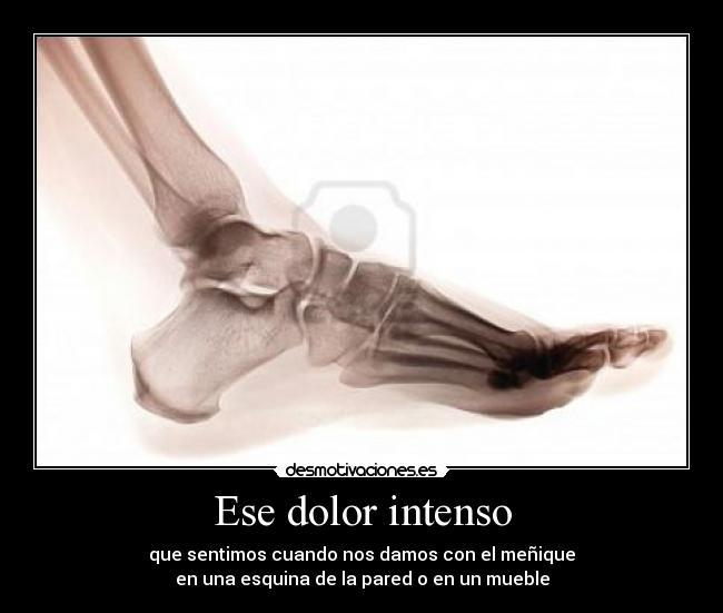 Ese dolor intenso -