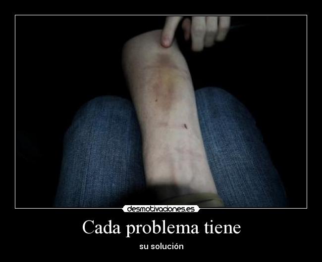 Cada problema tiene - su solución