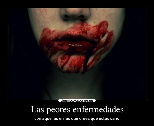 Las peores enfermedades -