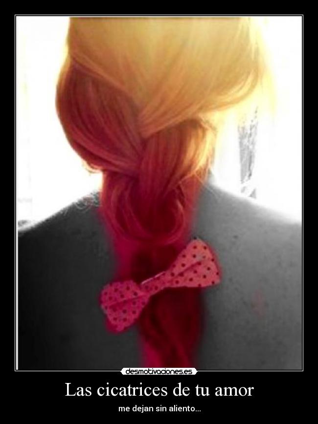 Las cicatrices de tu amor - me dejan sin aliento...