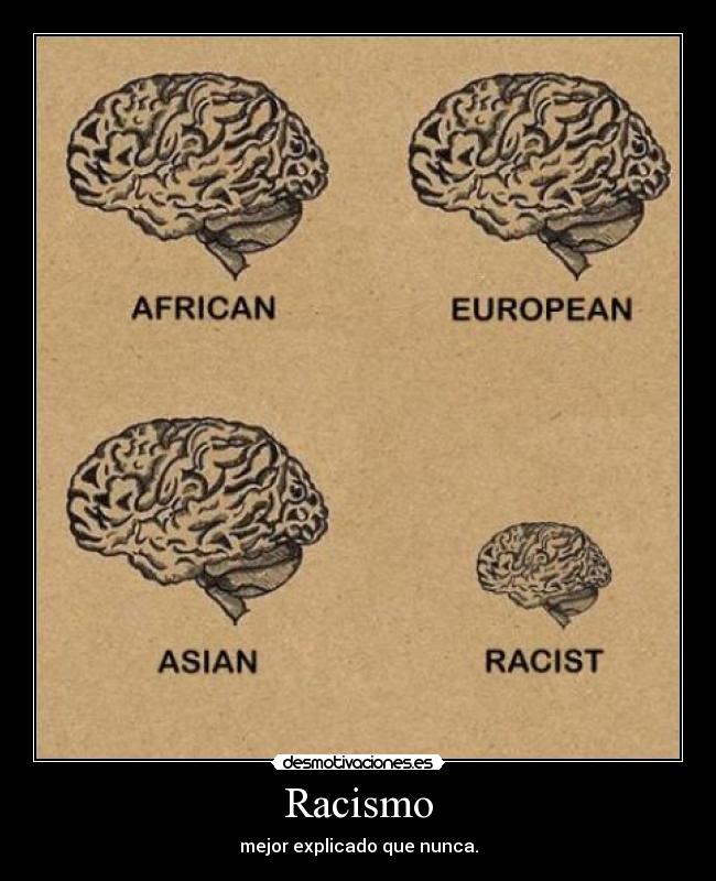 Racismo - mejor explicado que nunca.