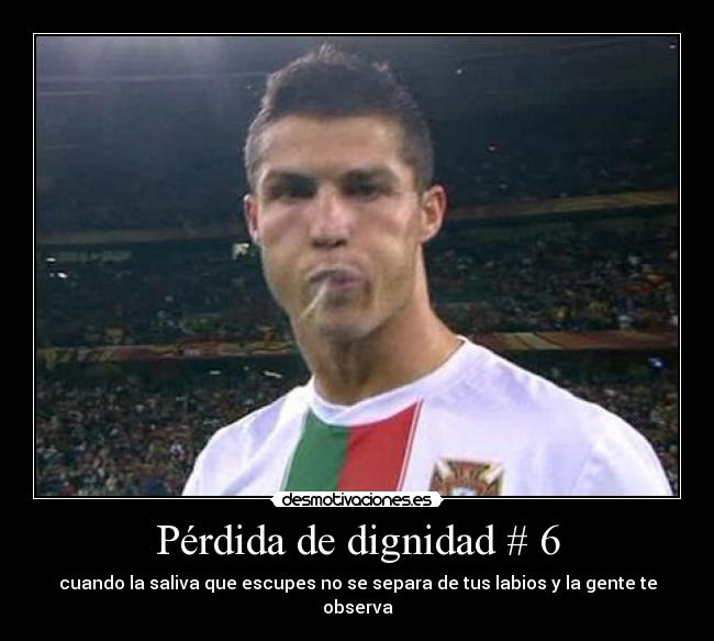 Pérdida de dignidad # 6 - cuando la saliva que escupes no se separa de tus labios y la gente te observa