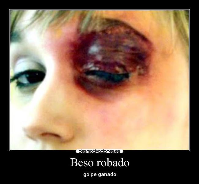 Beso robado - 