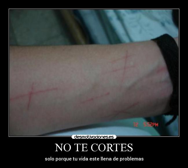 NO TE CORTES -