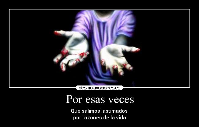 Por esas veces - Que salimos lastimados
por razones de la vida