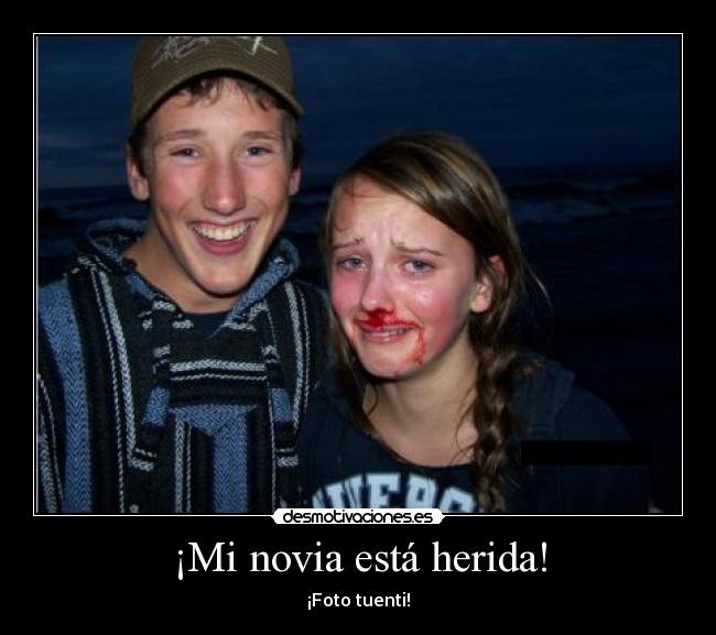 ¡Mi novia está herida! - ¡Foto tuenti!