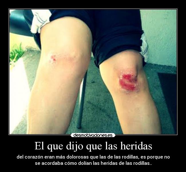 El que dijo que las heridas - del corazón eran más dolorosas que las de las rodillas, es porque no
se acordaba cómo dolían las heridas de las rodillas..