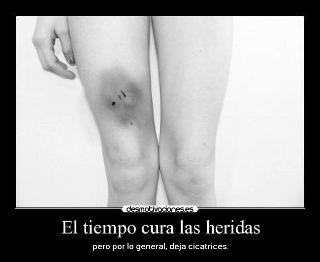 El tiempo cura las heridas - pero por lo general, deja cicatrices.