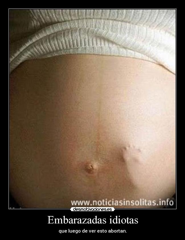 Embarazadas idiotas - 
