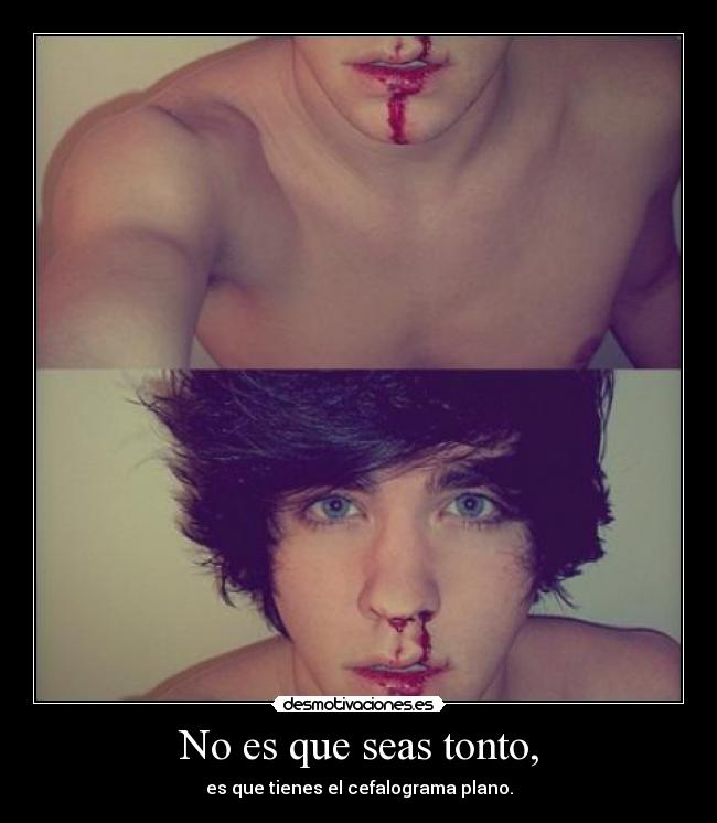 No es que seas tonto, - es que tienes el cefalograma plano.