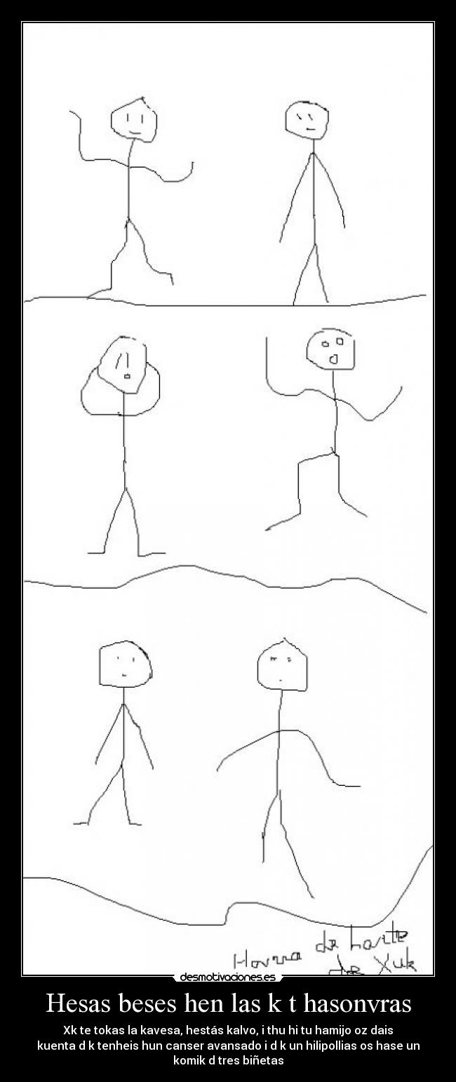 Hesas beses hen las k t hasonvras - Xk te tokas la kavesa, hestás kalvo, i thu hi tu hamijo oz dais
kuenta d k tenheis hun canser avansado i d k un hilipollias os hase un
komik d tres biñetas
