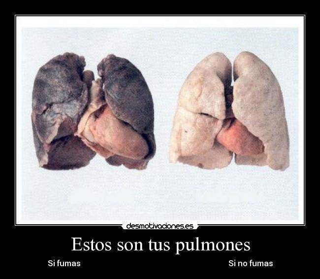 Estos son tus pulmones - Si fumas Si no fumas