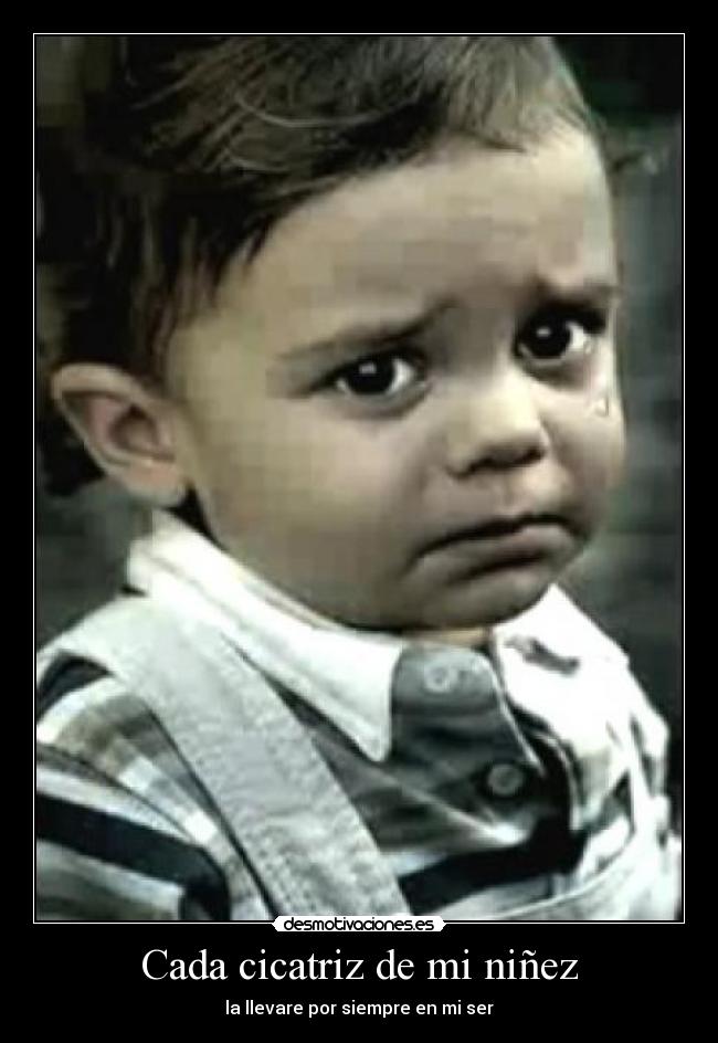 Cada cicatriz de mi niñez - la llevare por siempre en mi ser
