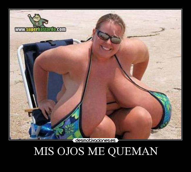 MIS OJOS ME QUEMAN -