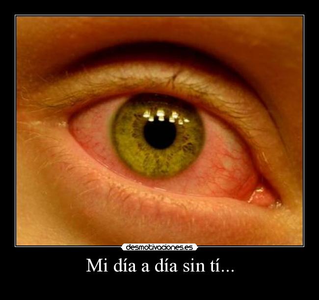 Mi día a día sin tí... -