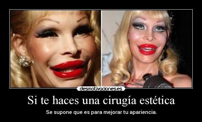 Si te haces una cirugía estética - 