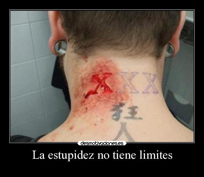 La estupidez no tiene limites -