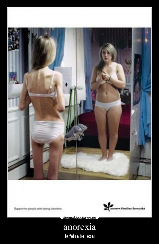 anorexia - la falsa belleza!