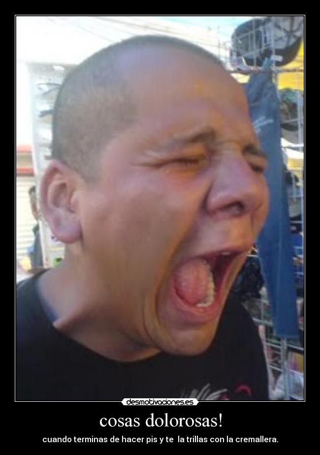 cosas dolorosas! -