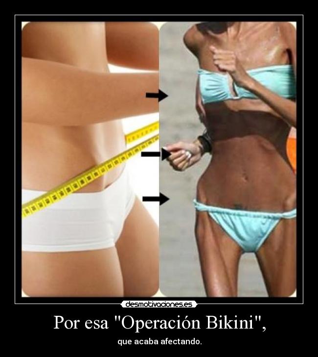 Por esa Operación Bikini, -