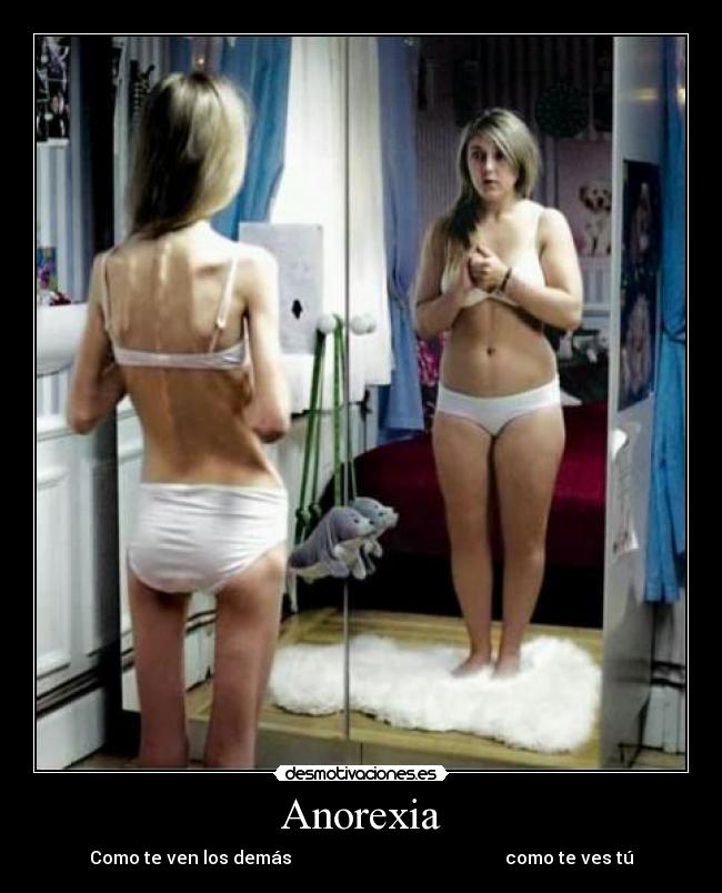 Anorexia - 