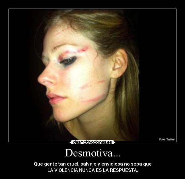 Desmotiva... - Que gente tan cruel, salvaje y envidiosa no sepa que
LA VIOLENCIA NUNCA ES LA RESPUESTA.