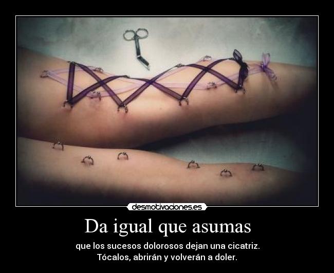 Da igual que asumas - que los sucesos dolorosos dejan una cicatriz.
Tócalos, abrirán y volverán a doler.