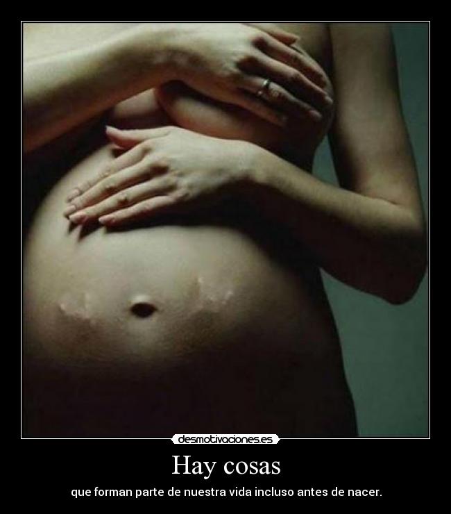 Hay cosas - que forman parte de nuestra vida incluso antes de nacer.