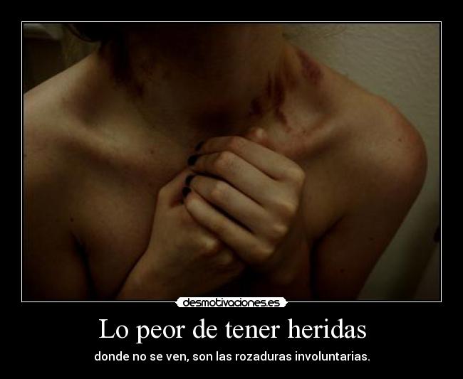 Lo peor de tener heridas -