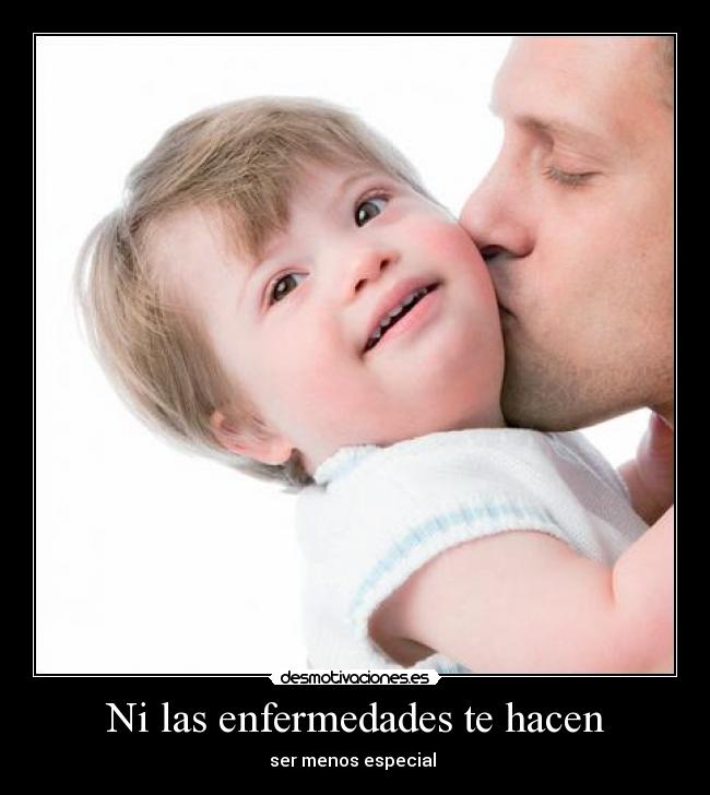 Ni las enfermedades te hacen - ser menos especial 