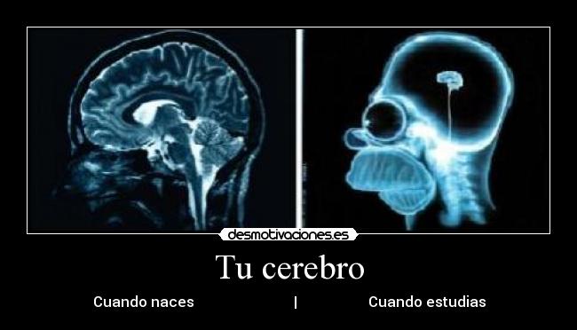 Tu cerebro - 