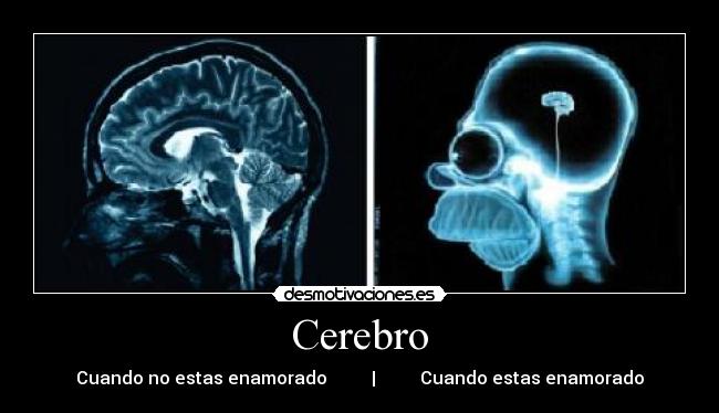 Cerebro - 