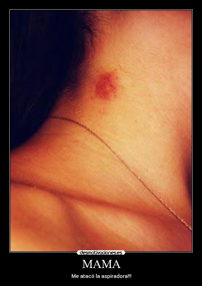 MAMA - Me atacó la aspiradora!!!