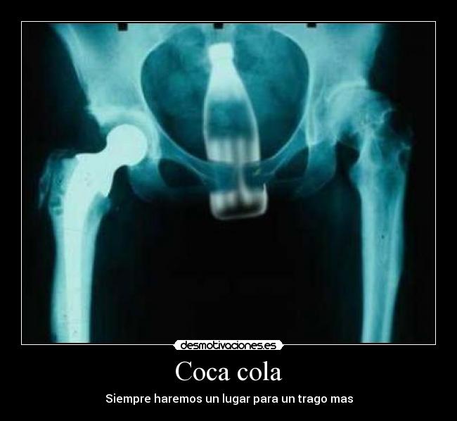 Coca cola -