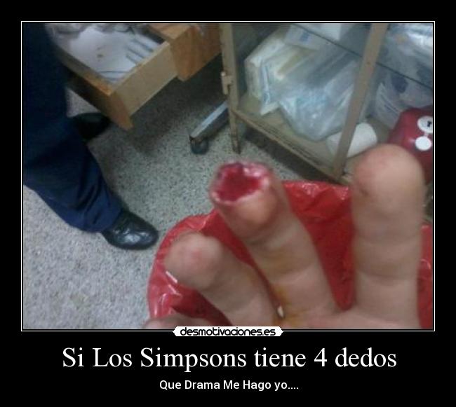 Si Los Simpsons tiene 4 dedos -