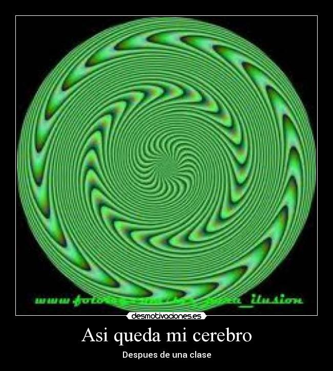 Asi queda mi cerebro -