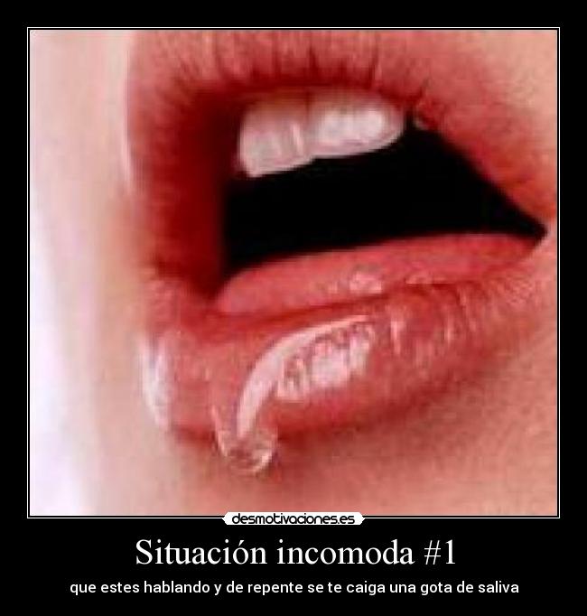 Situación incomoda #1 - que estes hablando y de repente se te caiga una gota de saliva