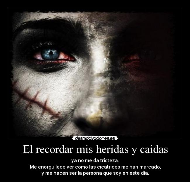 El recordar mis heridas y caidas - ya no me da tristeza.
Me enorgullece ver como las cicatrices me han marcado,
y me hacen ser la persona que soy en este día.