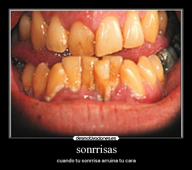 sonrrisas -
