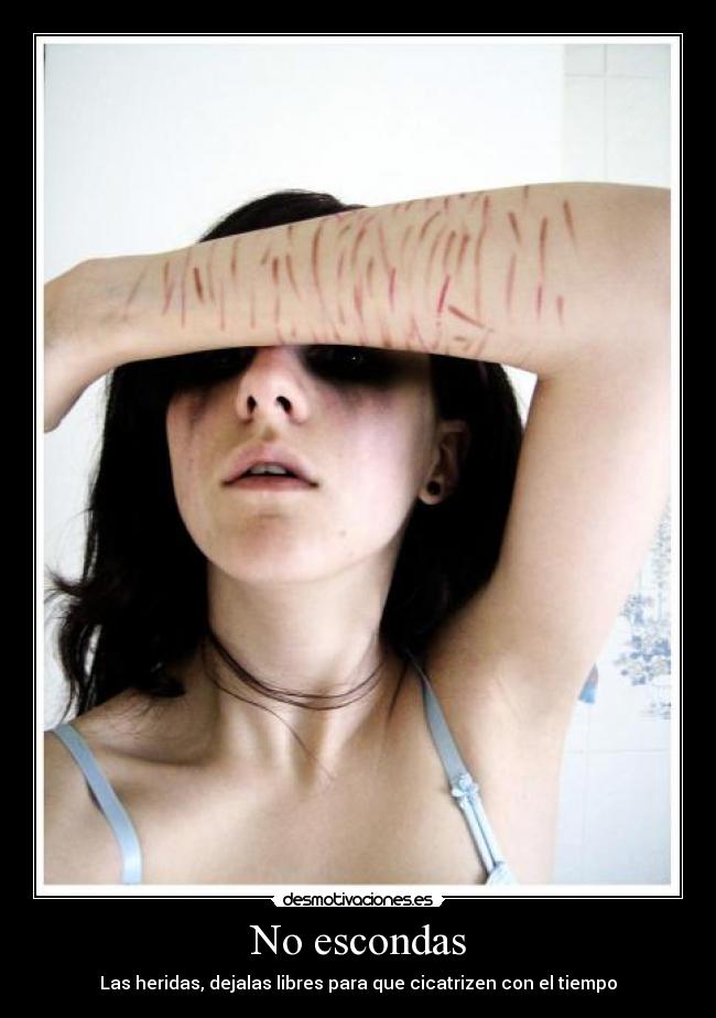 No escondas - Las heridas, dejalas libres para que cicatrizen con el tiempo