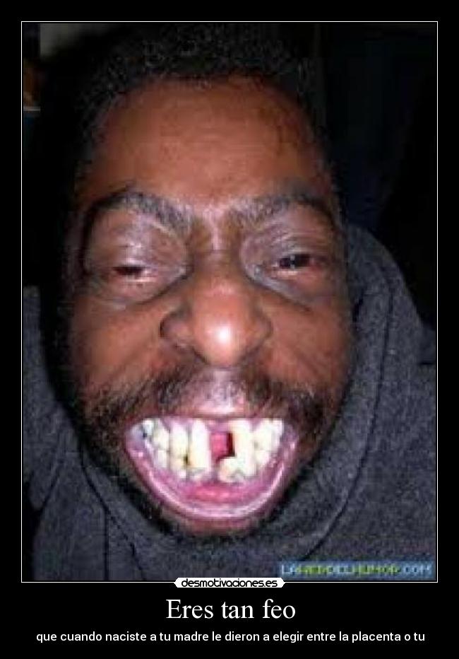 Eres tan feo - que cuando naciste a tu madre le dieron a elegir entre la placenta o tu