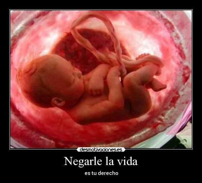 Negarle la vida - es tu derecho