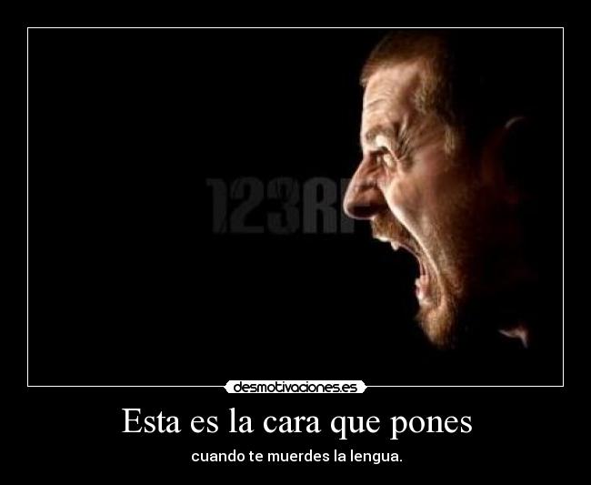 Esta es la cara que pones - cuando te muerdes la lengua.