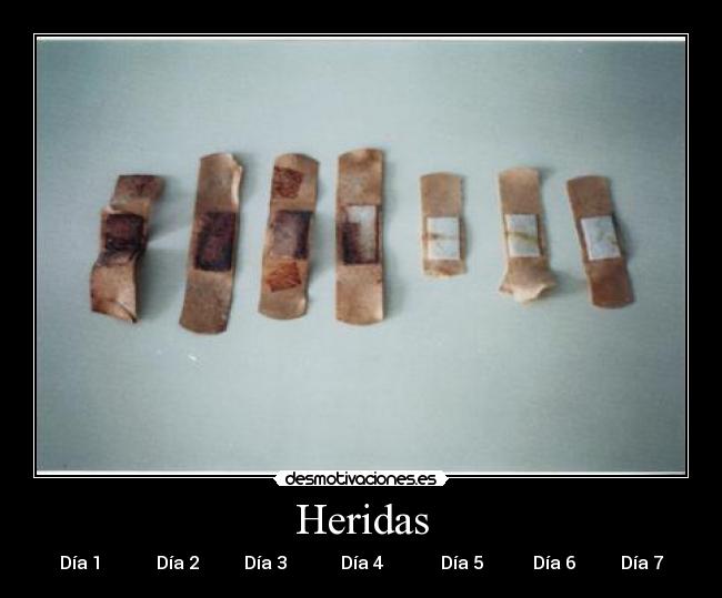 Heridas - Día 1 Día 2 Día 3 Día 4 Día 5 Día 6 Día 7