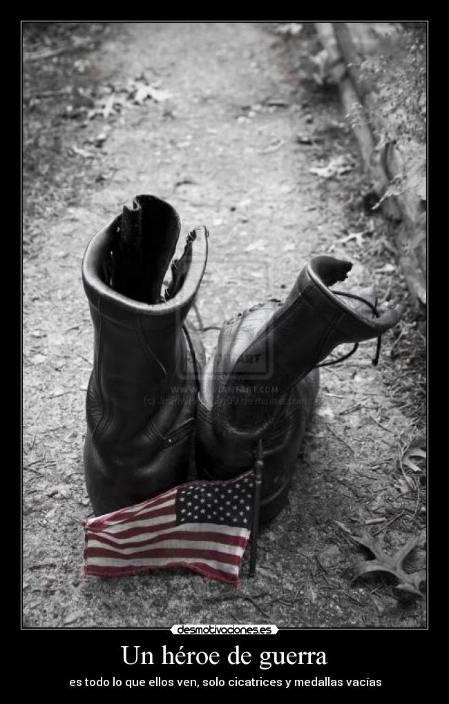 Un héroe de guerra - es todo lo que ellos ven, solo cicatrices y medallas vacías