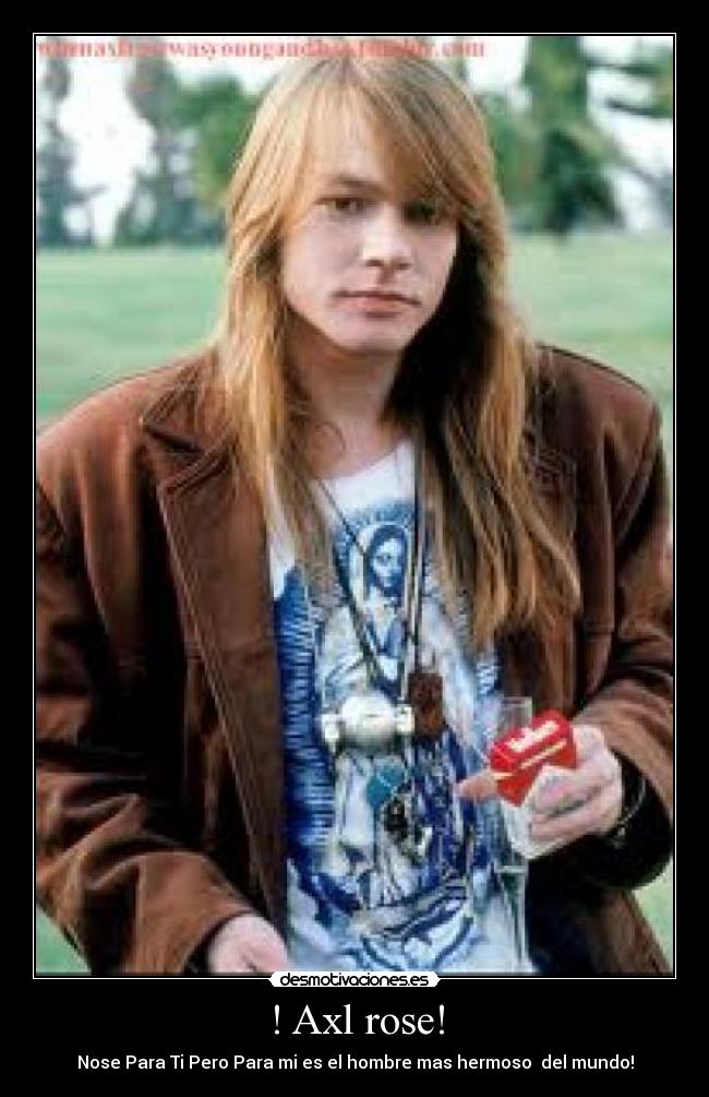 ! Axl rose! -