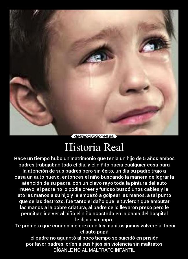 Historia Real - Hace un tiempo hubo un matrimonio que tenia un hijo de 5 años ambos
padres trabajaban todo el día, y el niñito hacia cualquier cosa para
la atención de sus padres pero sin éxito, un día su padre trajo a
casa un auto nuevo, entonces el niño buscando la manera de lograr la
atención de su padre, con un clavo rayo toda la pintura del auto
nuevo, el padre no lo podia creer y furioso buscó unos cables y le
ato las manos a su hijo y le empezó a golpear las manos, a tal punto
que se las destrozo, fue tanto el daño que le tuvieron que amputar
las manos a la pobre criatura, al padre se lo llevaron preso pero le
permitían ir a ver al niño el niño acostado en la cama del hospital
le dijo a su papá 
- Te prometo que cuando me crezcan las manitos jamas volveré a  tocar
el auto papá
el padre no aguantó al poco tiempo se suicidó en prisión
por favor padres, críen a sus hijos sin violencia sin maltratos
DÍGANLE NO AL MALTRATO INFANTIL