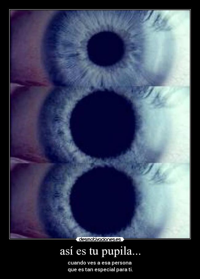 así es tu pupila... -